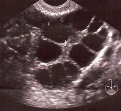 Austin-IVF-Ultrasound (1)