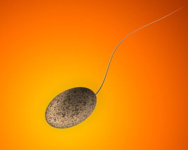 sperm-quality-male-infertility