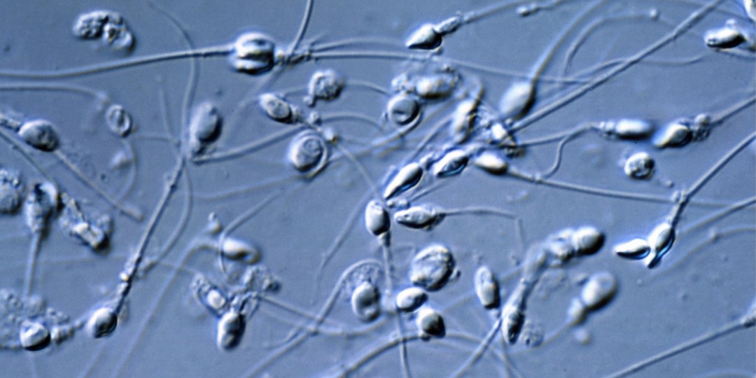 semen-analysis-andrology-lab-austin-fertility
