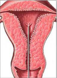 endometrial-scratching-austin-fertility