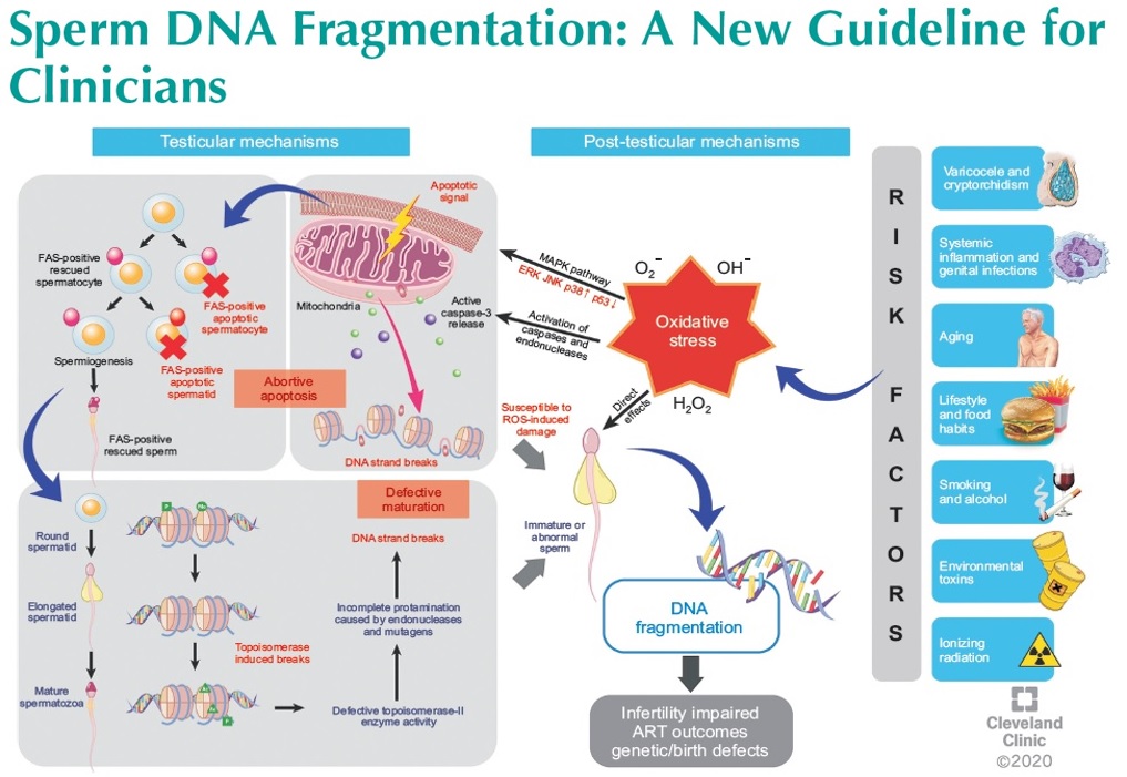 Sperm DNA Fragmentation - Male Infertility - Parviz Kavoussi