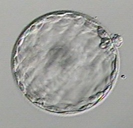 Blastocyst - Austin Fertility - Dr. Shahryar Kavoussi